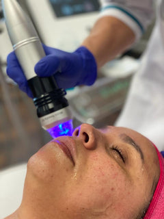 Clearance Goldskin Fractional Micro Needle RF