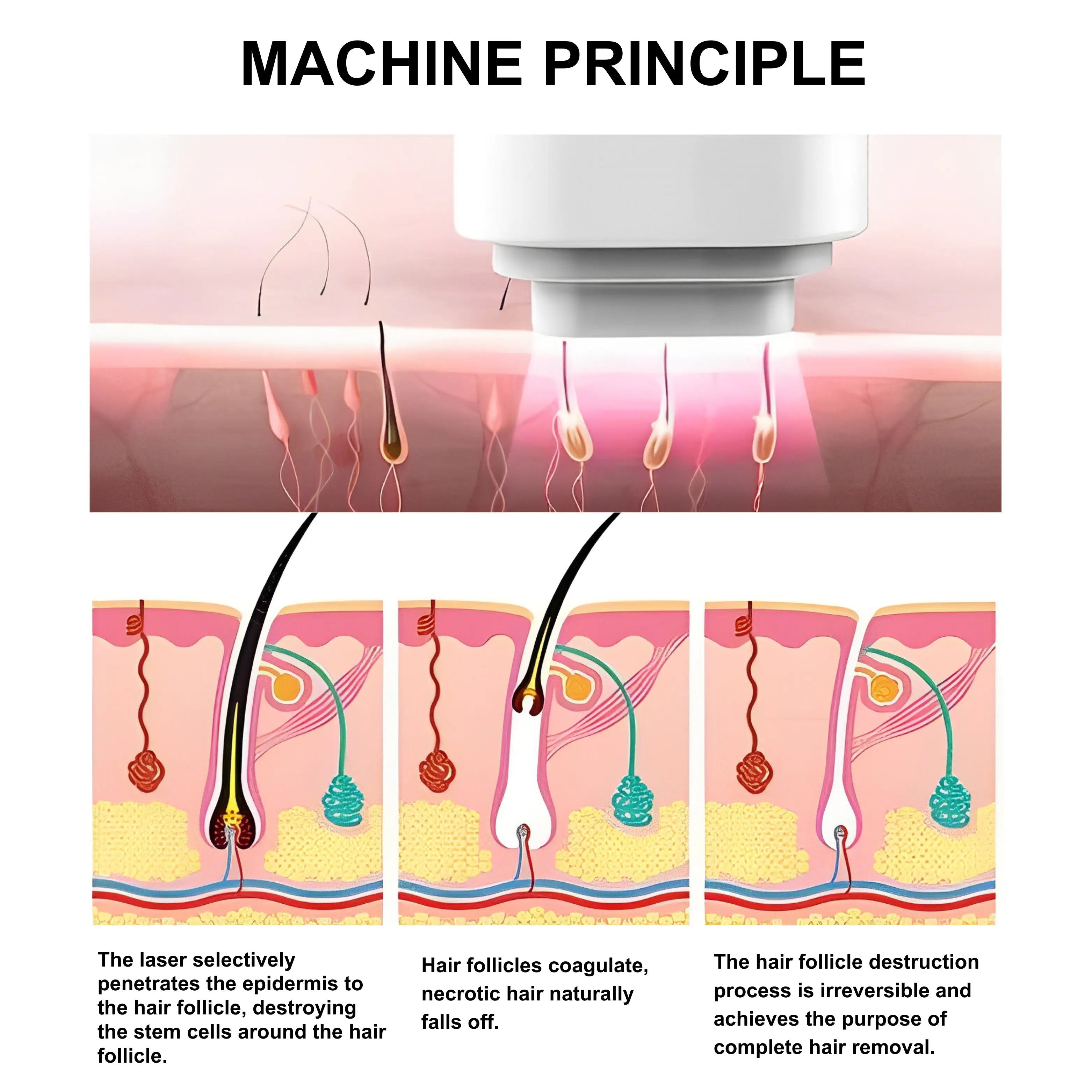 808 nm Diode Laser For Hair Removal LitePro