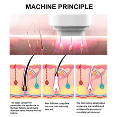 808 nm Diode Laser For Hair Removal LitePro