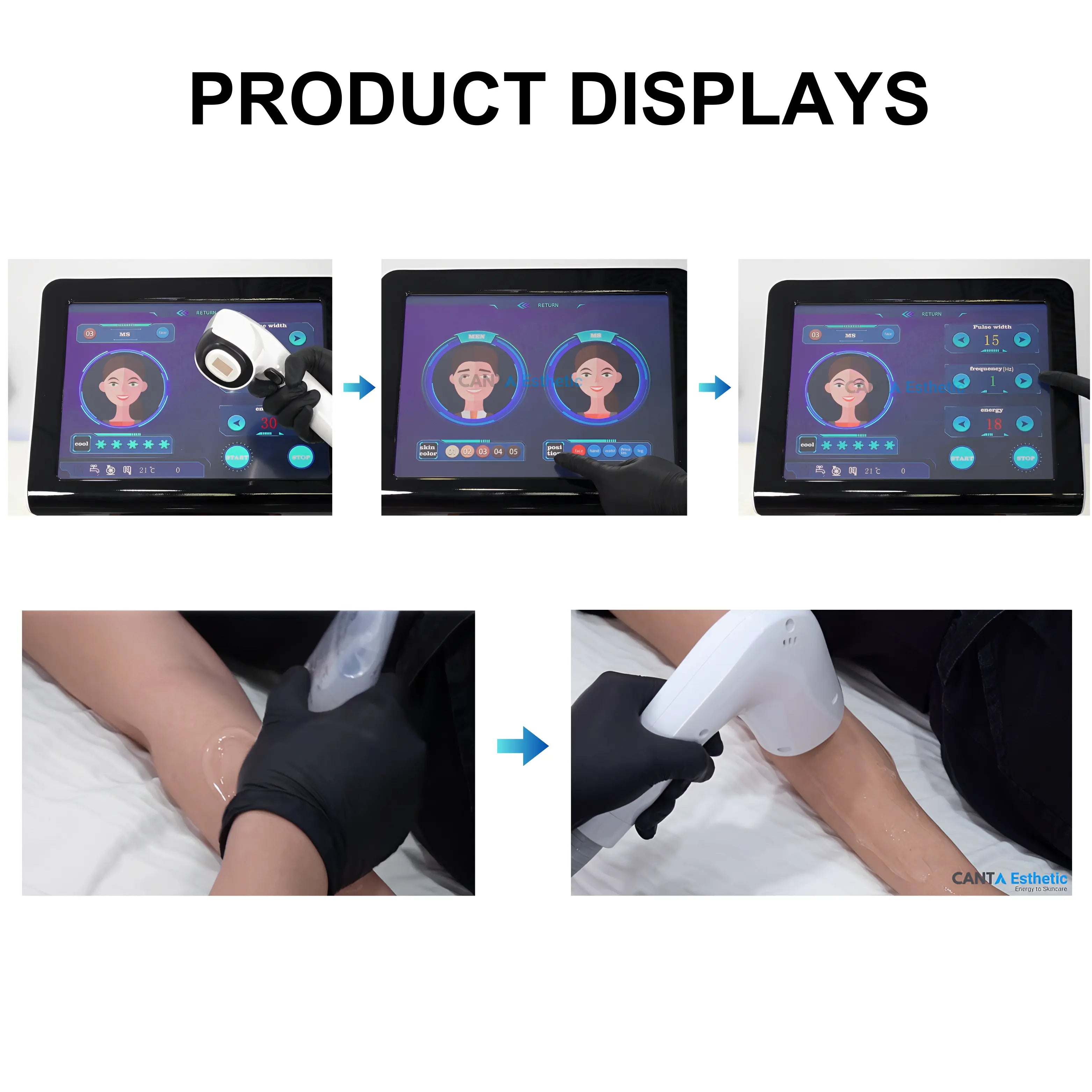 808 nm Diode Laser For Hair Removal LitePro