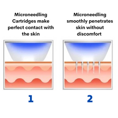 Beauty Disruptor™ RF Microneedling Machine 3 in 1