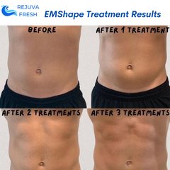 EMShape® Neo Android Body Contouring Machine