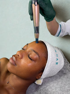 Velvet Microneedling Pen (FDA-approved medical grade)