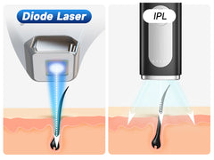 ViQure EpiPro 808nm Diode Laser Hair Removal Device
